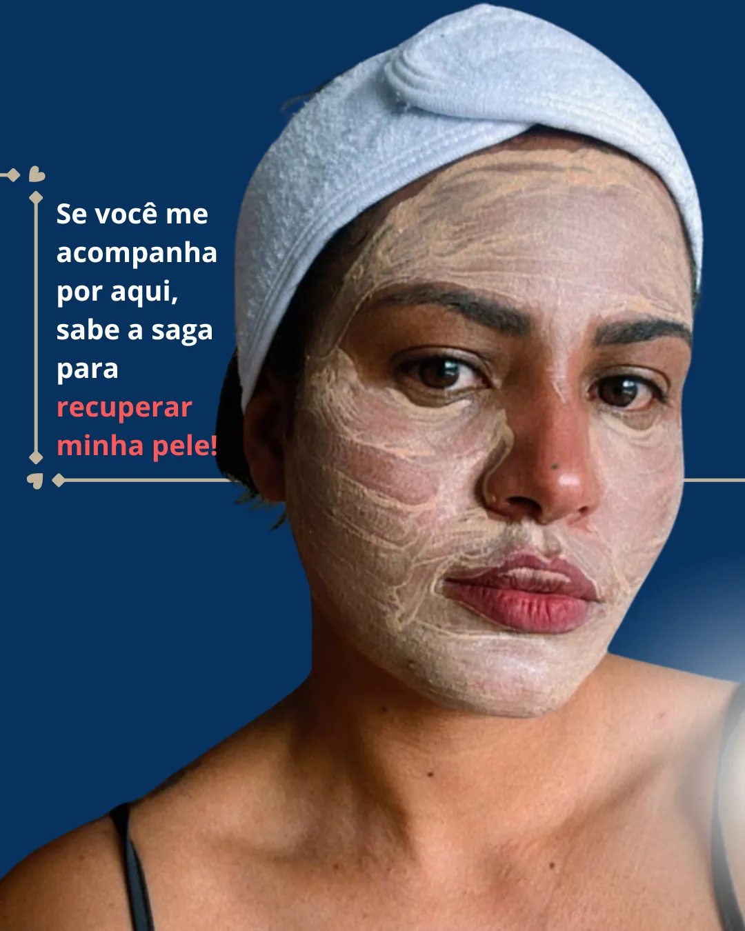 Naiara com uma máscara facial, no percurso para recuperar a pele
