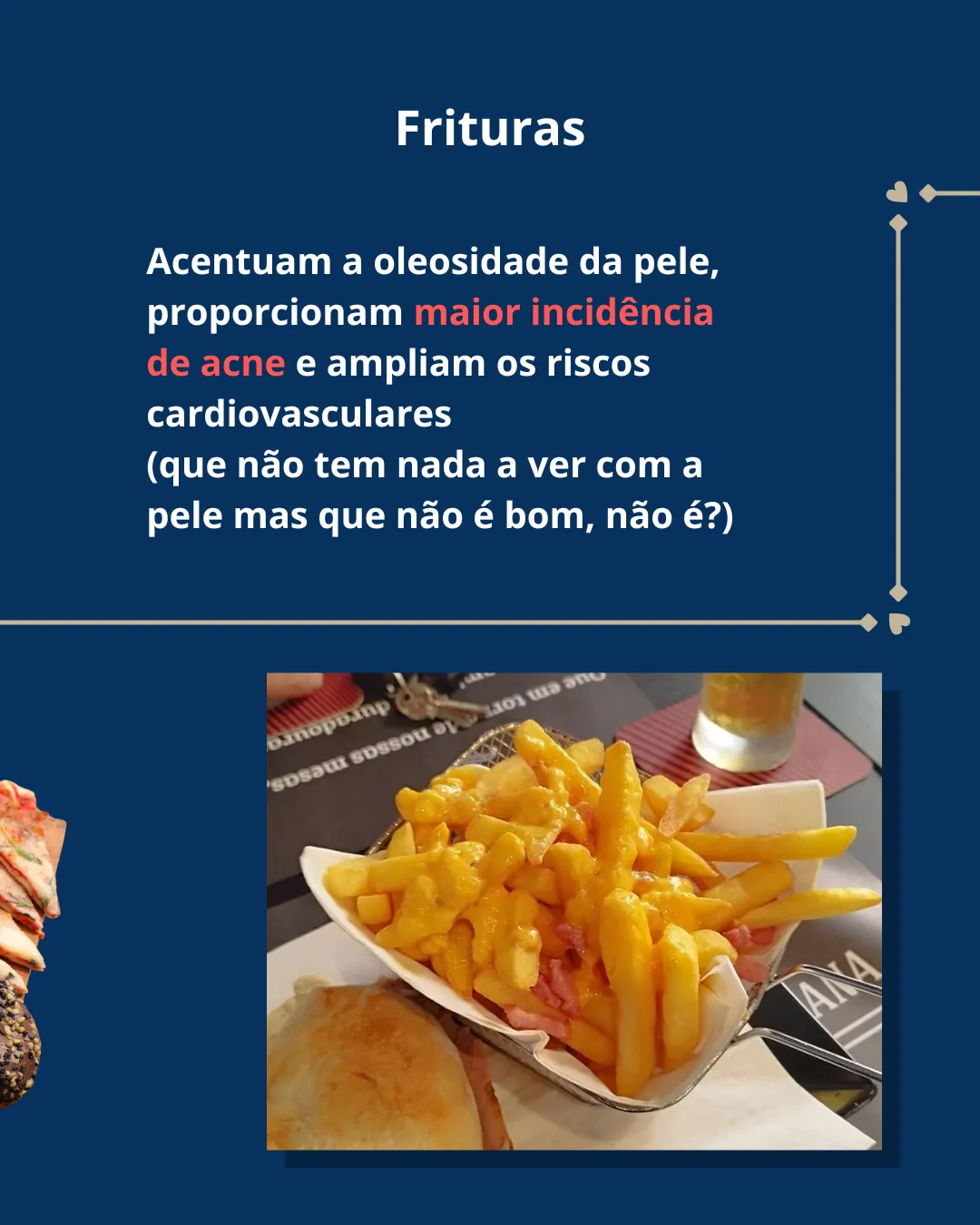 Fritos: o efeito das frituras na oleosidade da pele e na acne