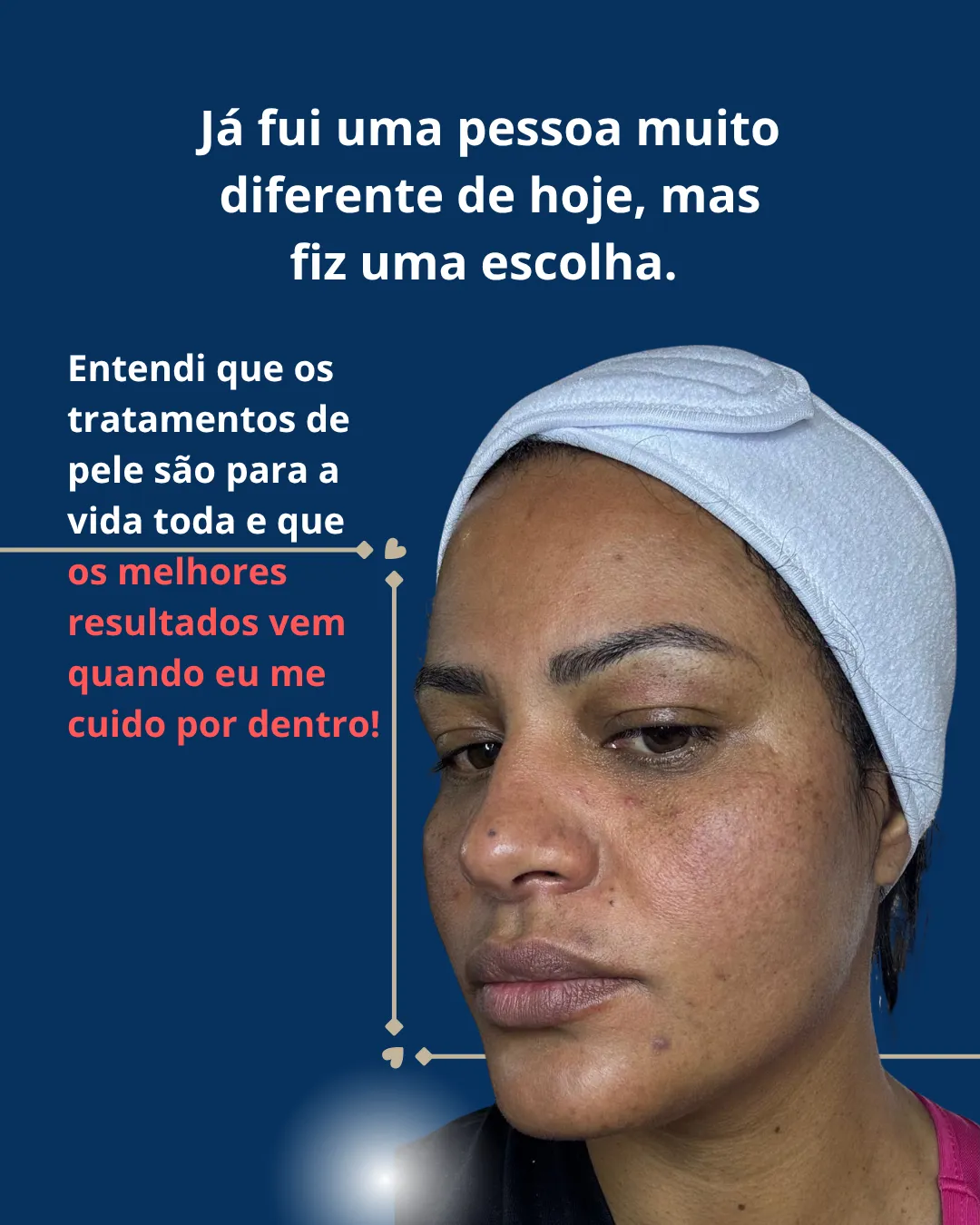 Retrato da Naiara sem filtros: para ela, cuidar da pele é um hábito para toda a vida
