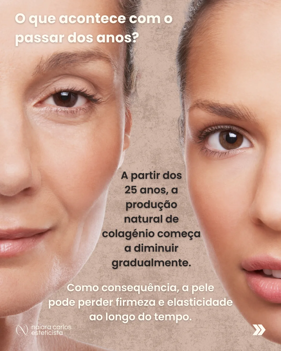 A partir dos 25 anos, a produção natural de colagénio começa a diminuir gradualmente, e a pele pode perder firmeza e elasticidade ao longo do tempo
