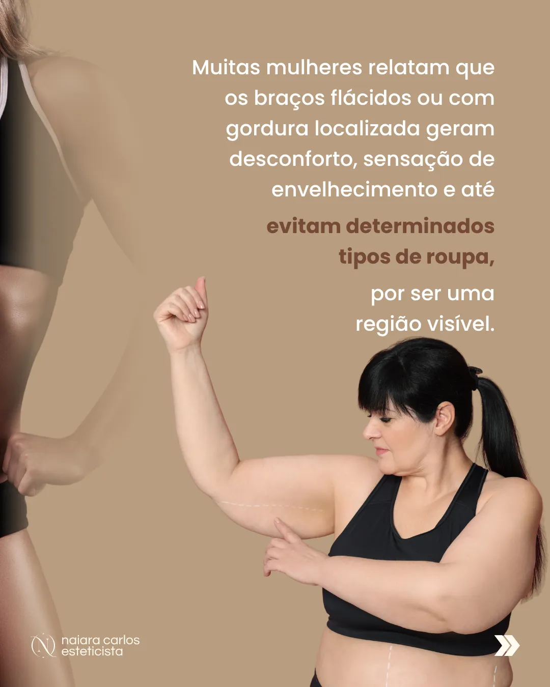 Mulher a examinar a parte posterior do braço, com linhas de referência marcadas sobre o braço e o abdómen