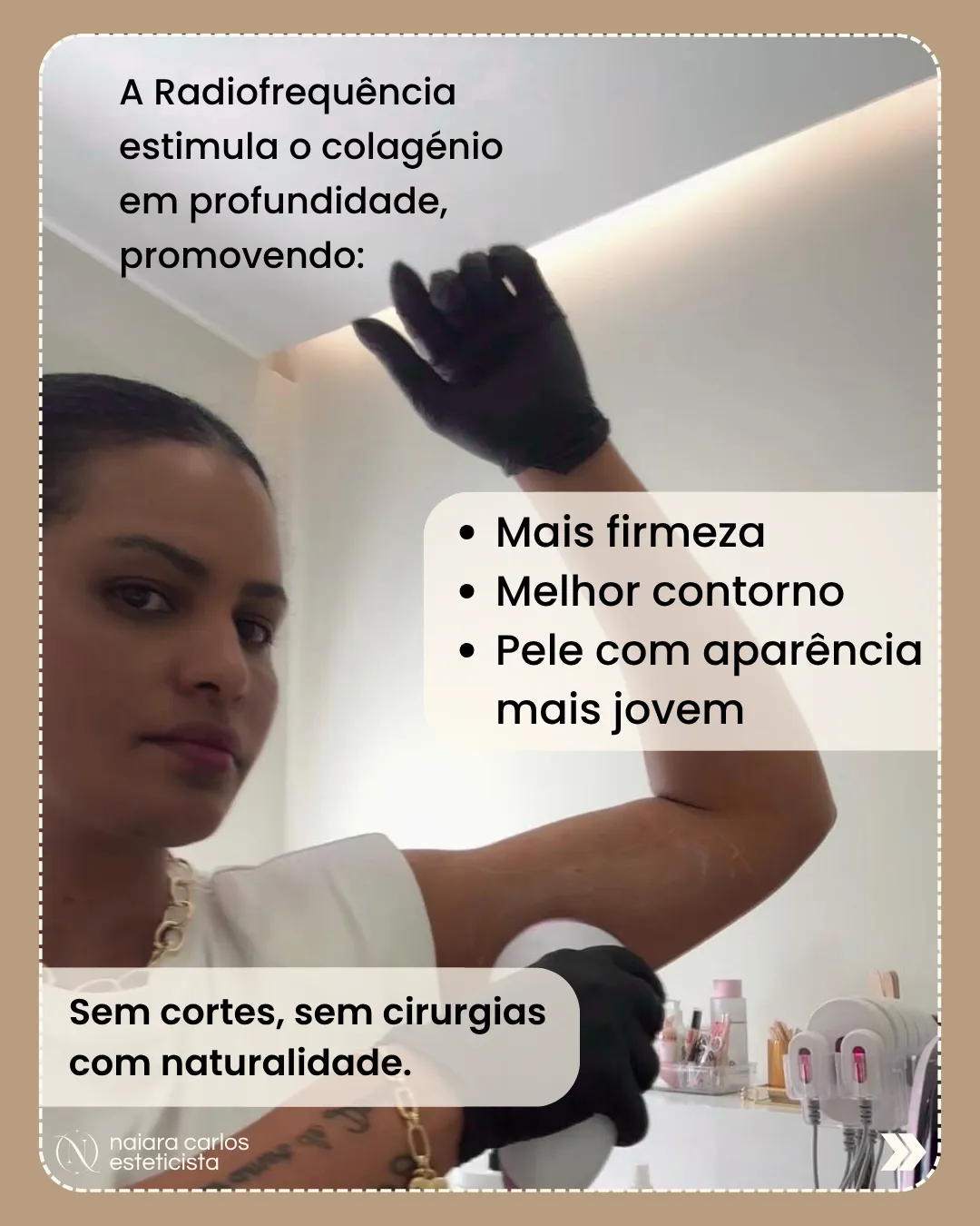 Sessão de radiofrequência no braço, a estimular colagénio para mais firmeza e melhor contorno, sem cortes nem cirurgias
