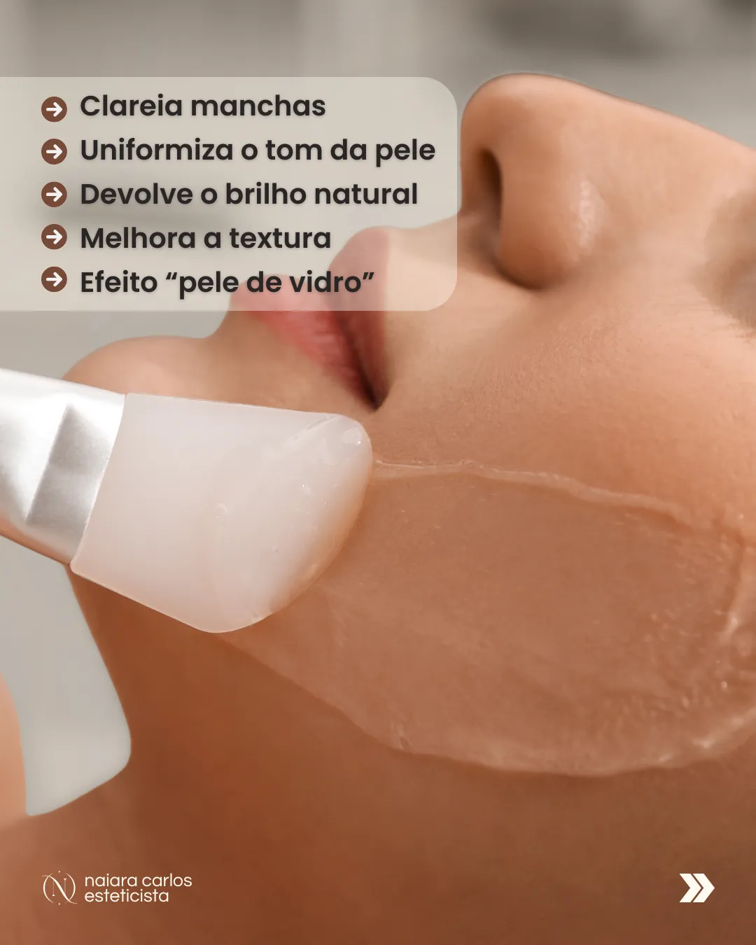 Aplicação do Prisma Peeling em cabine: clareia manchas, uniformiza o tom, devolve o brilho, melhora a textura e dá o efeito pele de vidro