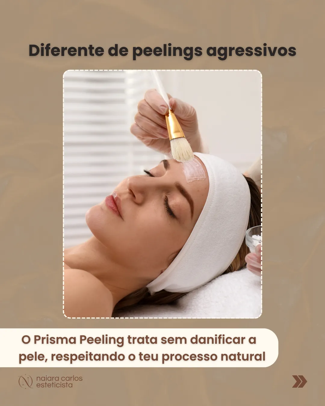 Aplicação de um peeling com pincel, em cabine: o Prisma Peeling trata sem danificar a pele, respeitando o seu processo natural