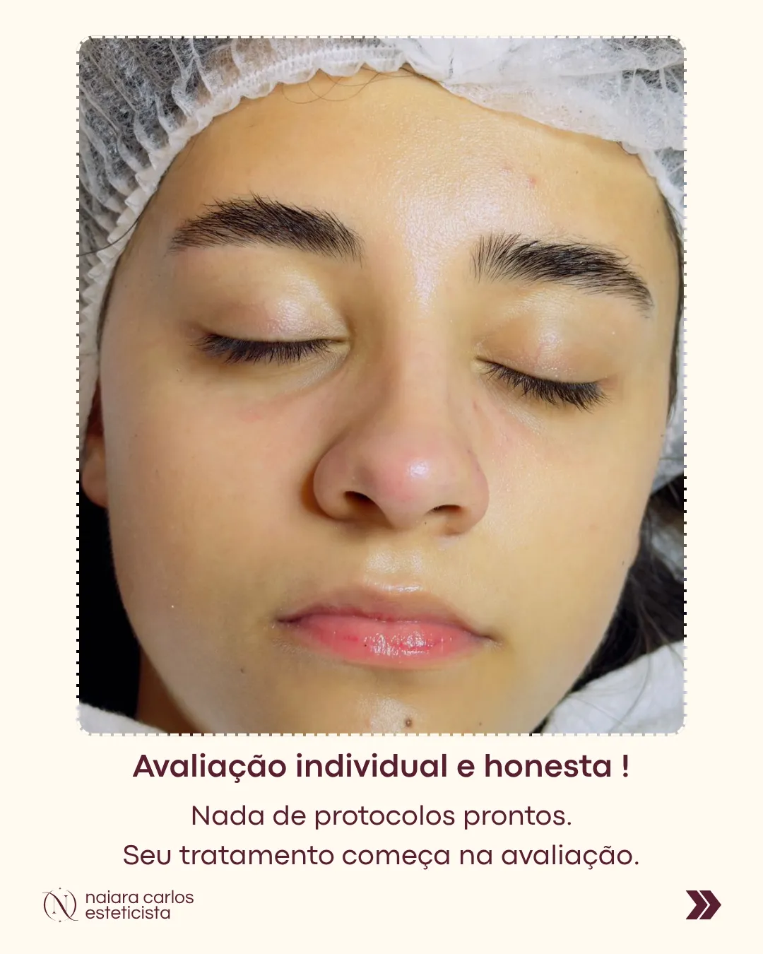 Avaliação facial individual antes de qualquer indicação, sem tratamento decidido à partida