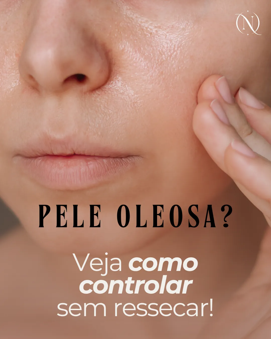 Pele oleosa: como controlar o brilho sem ressecar a pele
