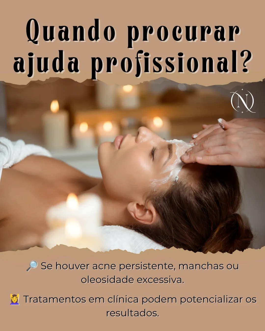 Quando procurar ajuda profissional: acne persistente, manchas ou oleosidade excessiva