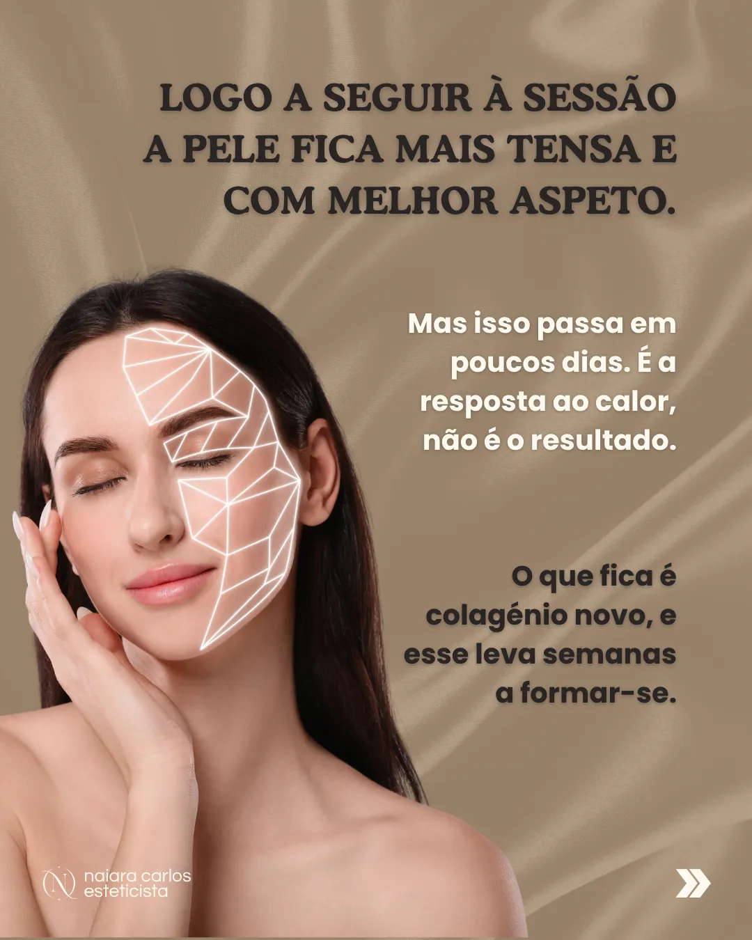 Rosto de mulher com uma malha geométrica sobreposta: logo a seguir à sessão a pele fica mais tensa e com melhor aspeto, mas isso passa em poucos dias, é a resposta ao calor e não o resultado. O que fica é colagénio novo, e esse leva semanas a formar-se
