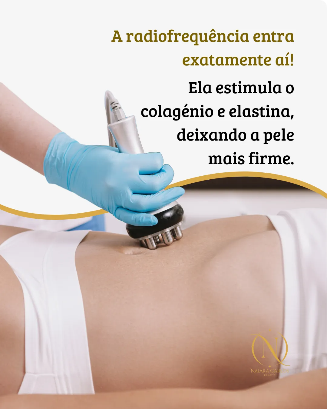 Aplicação de radiofrequência no abdómen, para estimular o colagénio e a elastina e deixar a pele mais firme