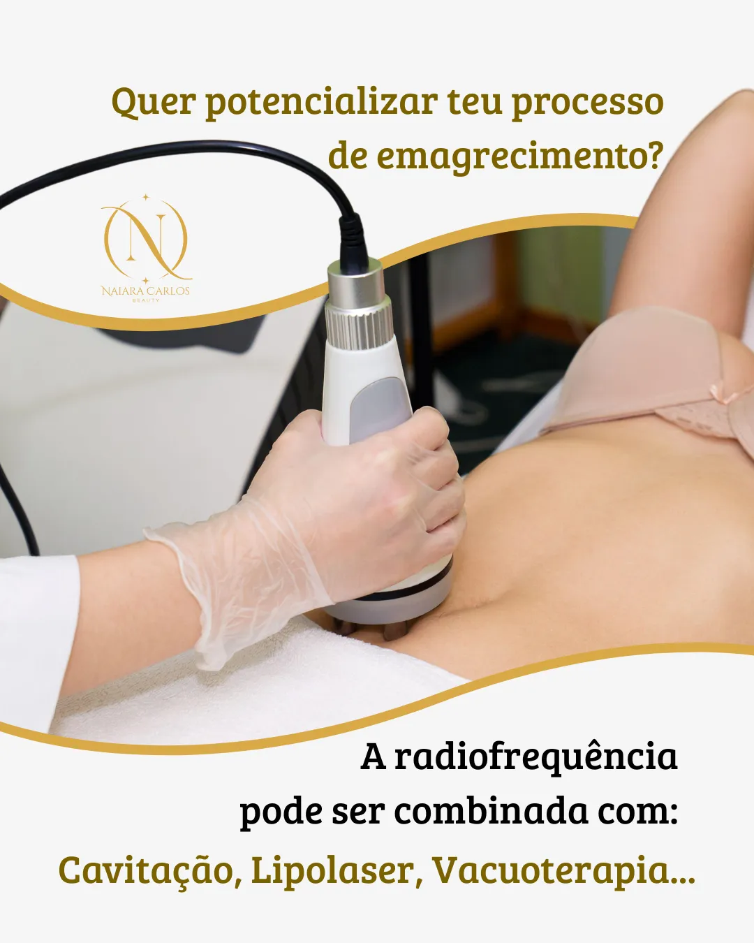 A radiofrequência pode ser combinada com outras tecnologias, como cavitação, lipolaser ou vacuoterapia