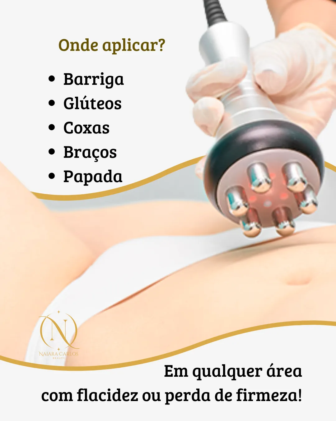 Onde aplicar a radiofrequência corporal: barriga, glúteos, coxas, braços e papada, em qualquer área com flacidez ou perda de firmeza