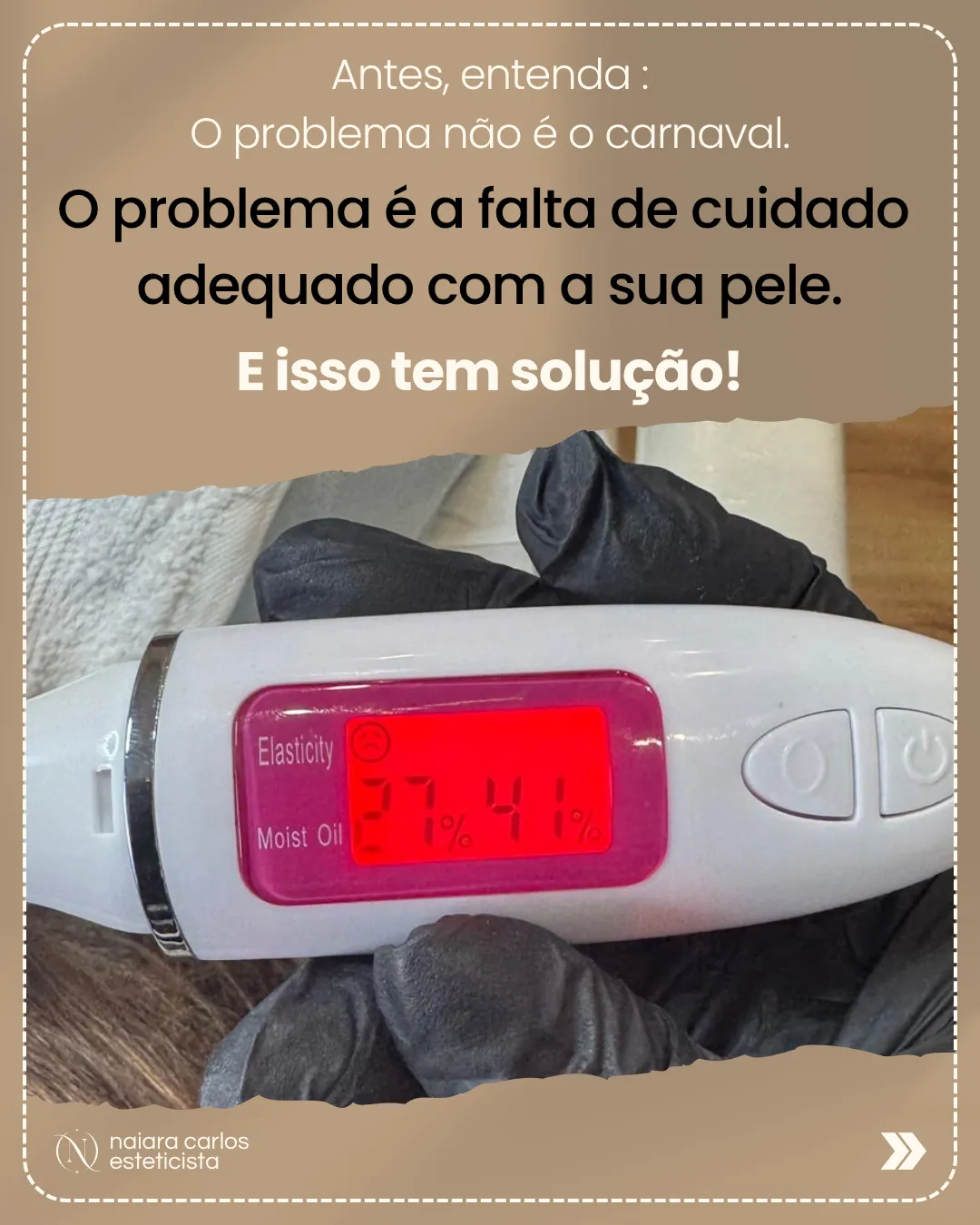 Aparelho de análise de pele durante uma avaliação, com leituras baixas de elasticidade e de hidratação: o problema não é a festa, é a falta de cuidado adequado depois