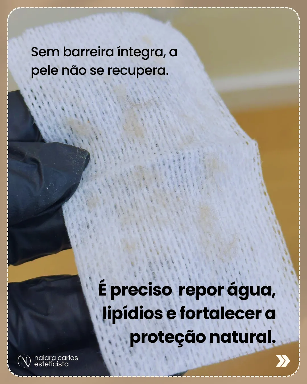 Compressa usada numa limpeza de pele profissional, com os resíduos removidos: sem barreira íntegra a pele não recupera, é preciso repor água e lípidos