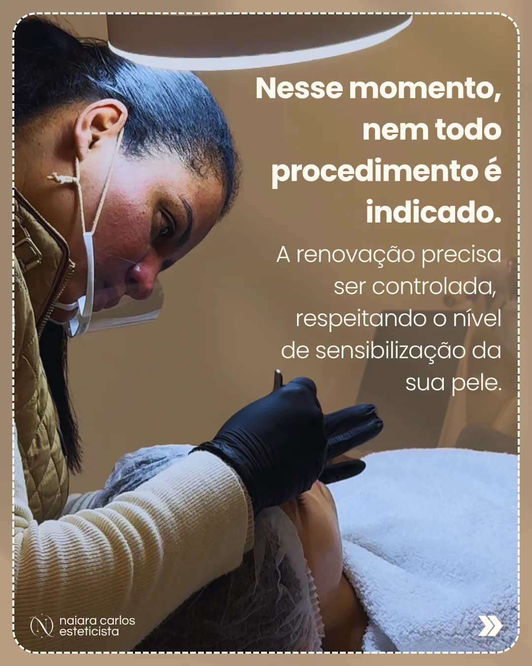 Naiara Carlos a avaliar o nível de sensibilização da pele antes de indicar qualquer procedimento, porque a renovação precisa de ser controlada